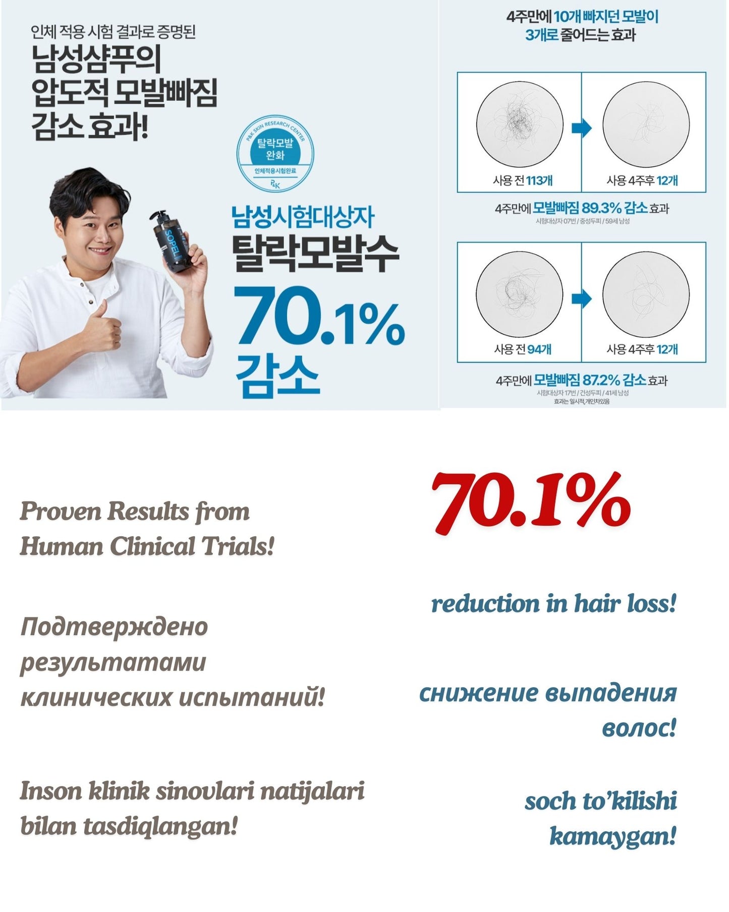 Sopel Blocker12 Premium Men’s Hair Loss Shampoo - Erkaklar Uchun Soch To'kilishiga Qarshi Premium Shampun, DHTni bloklaydi